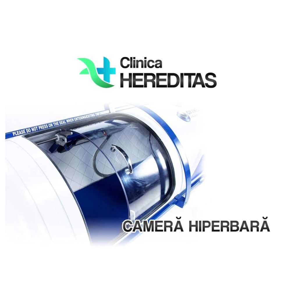 camera hiperbara